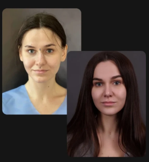 Риносептопластика