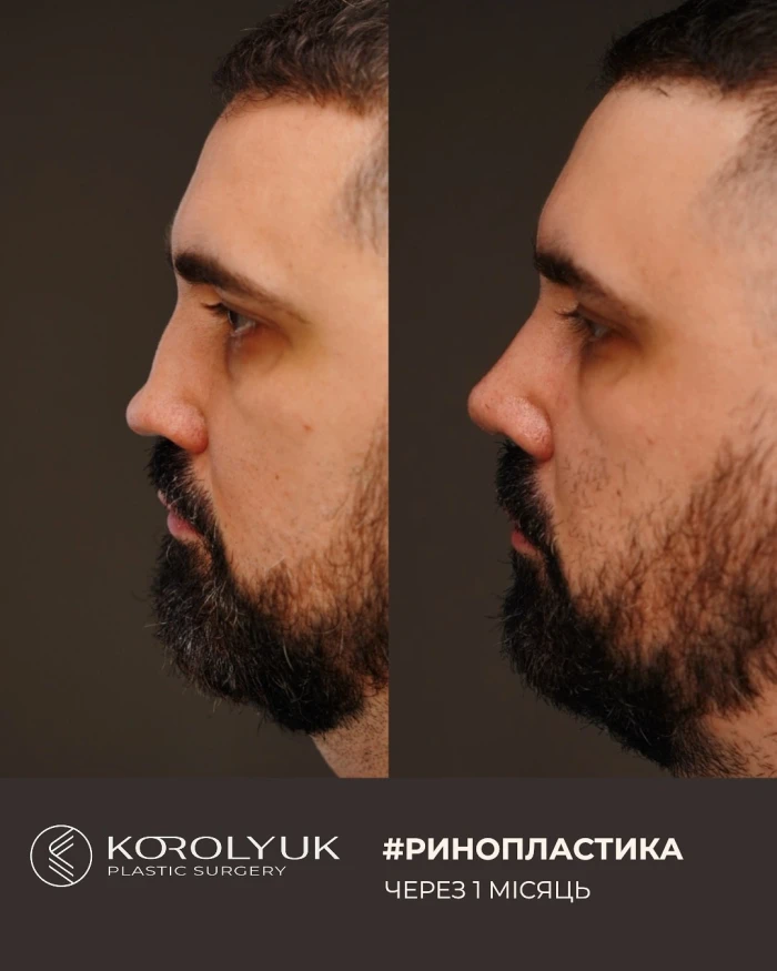 Кейс 3