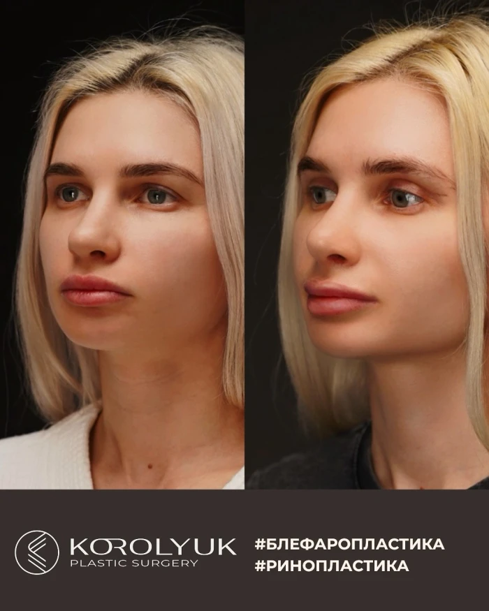 Кейс 6