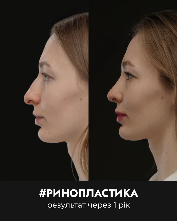 Кейс 8