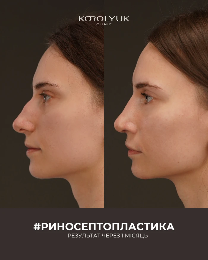 Кейс 1