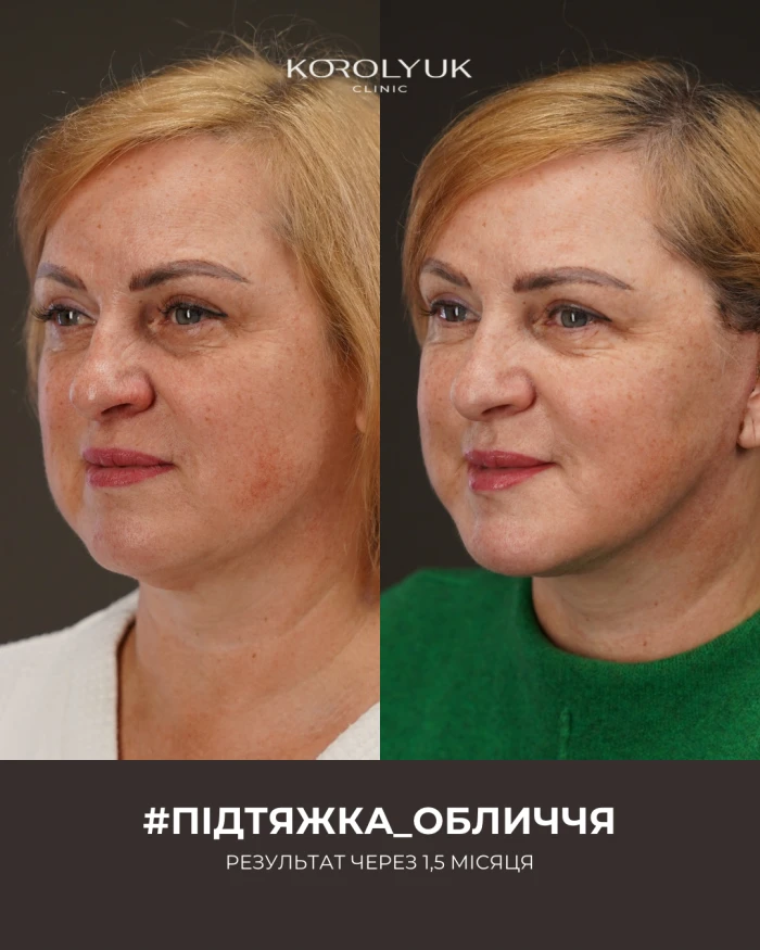 Кейс 1