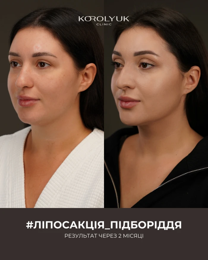 Кейс 1