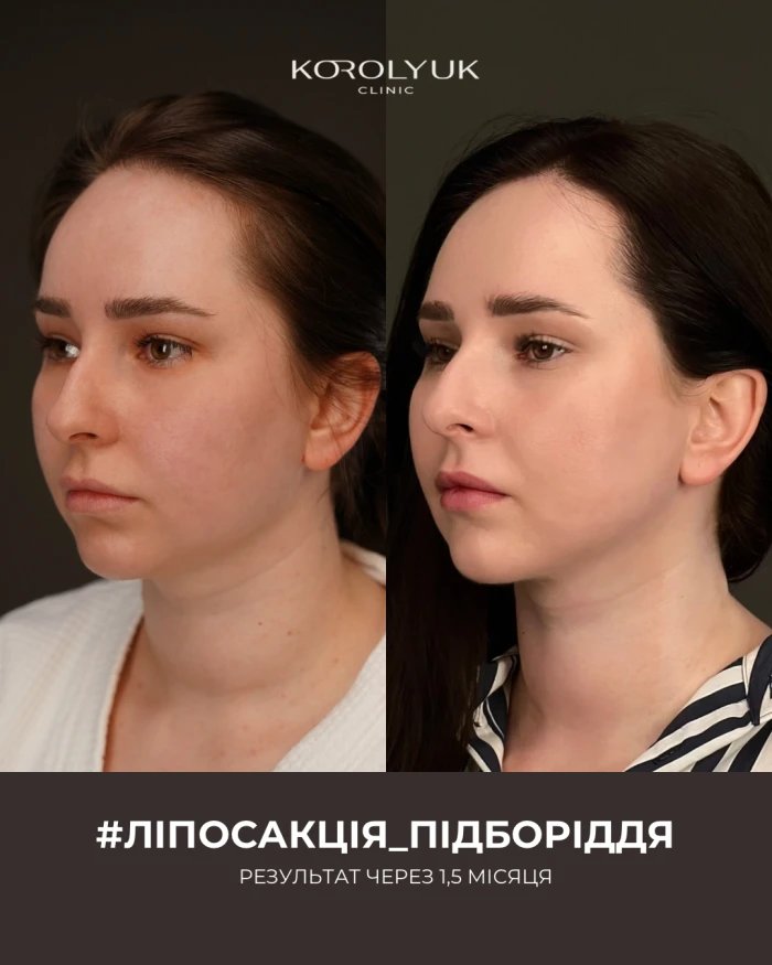 Кейс 2