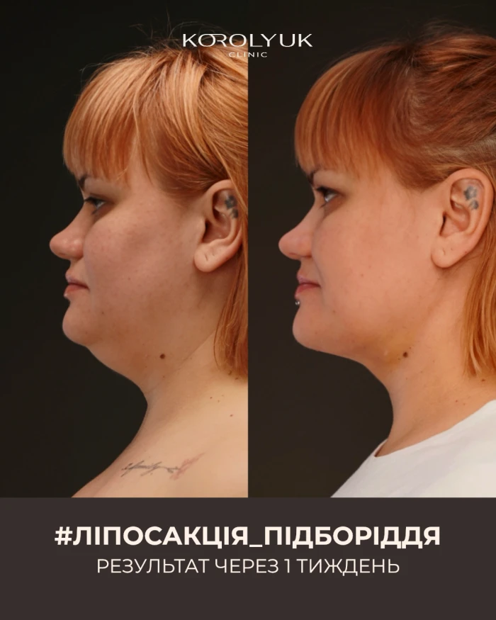 Кейс 3