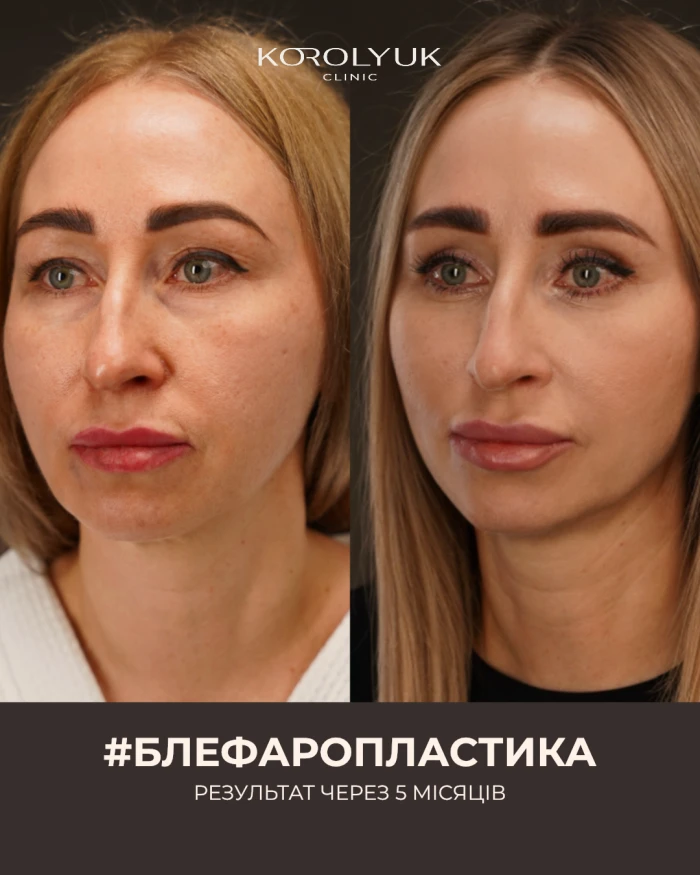 Кейс 2