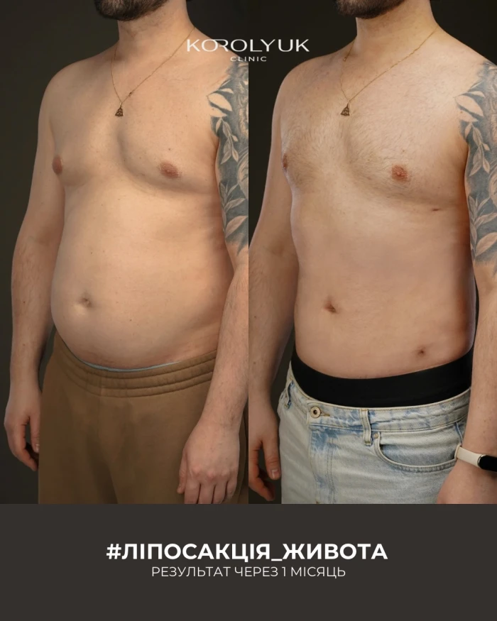 Кейс 1